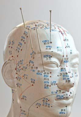 רפאל רוזנסקי - מטפל ברפואה סינית